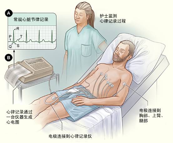 冠心病需要做哪些檢查？(圖1)